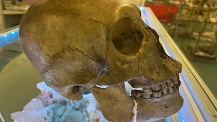 Skull