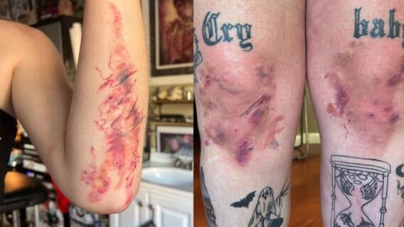 tattoos 568x319 - This Tattoo Artist Creates Realistic Bruises, Scrapes and Scars [Images]